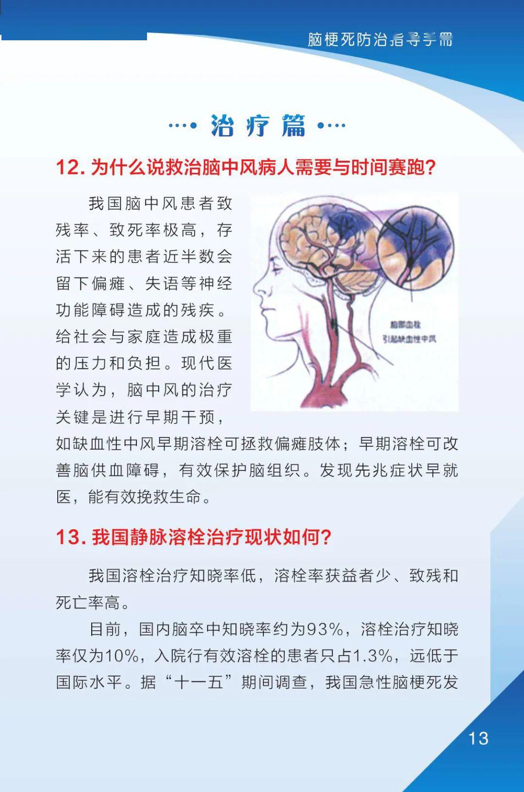 最新腦梗研究進(jìn)展與預(yù)防策略